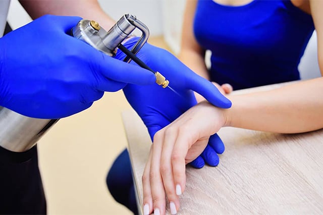 cryosurgery